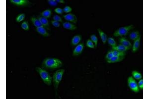 Immunofluorescent analysis of HepG2 cells using ABIN7143514 at dilution of 1:100 and Alexa Fluor 488-congugated AffiniPure Goat Anti-Rabbit IgG(H+L) (ARL6IP1 antibody  (AA 93-133))