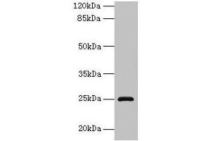 Western blot All lanes: RAB32 antibody at 3 μg/mL + Mouse kidney tissue Secondary Goat polyclonal to rabbit IgG at 1/10000 dilution Predicted band size: 25 kDa Observed band size: 25 kDa (RAB32 antibody  (AA 2-225))