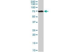 ACSL5 polyclonal antibody  (1 ug/mL) staining of human spleen lysate (35 ug protein in RIPA buffer). (ACSL5 antibody)