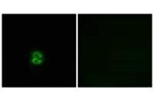 Immunofluorescence analysis of A549 cells, using CHST6 antibody. (CHST6 antibody)
