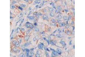 IHC-P analysis of Human Tissue, with DAB staining. (Lrig1 antibody  (AA 739-995))