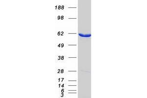 Validation with Western Blot (MCCC2 Protein (Myc-DYKDDDDK Tag))