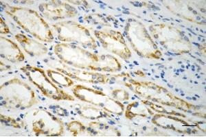 anti-Inner Membrane Protein, Mitochondrial (IMMT) antibody