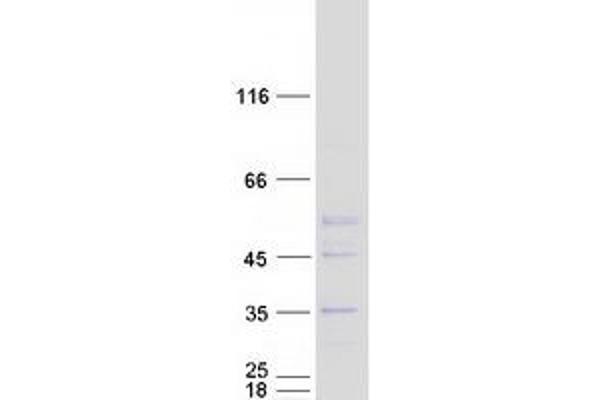 ELP6 Protein (Myc-DYKDDDDK Tag)