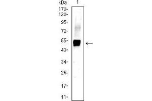 Western blot analysis using KRT13 mouse mAb against A431 (1) cell lysate. (Cytokeratin 13 antibody  (AA 104-458))