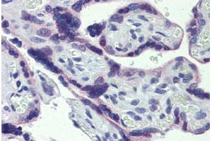 Placenta, Human: Formalin-Fixed, Paraffin-Embedded (FFPE) (STAT5B antibody  (N-Term))
