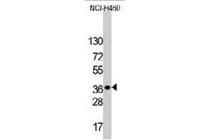 Western blot analysis of LDLRAP1 polyclonal antibody  in NCI-H460 cell line lysates (35 ug/lane). (LDLRAP1 antibody  (C-Term))