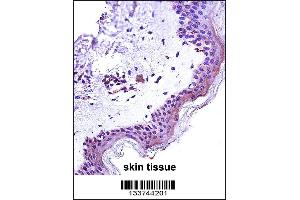 STAT2 Antibody immunohistochemistry analysis in formalin fixed and paraffin embedded human skin tissue followed by peroxidase conjugation of the secondary antibody and DAB staining. (STAT2 antibody  (N-Term))