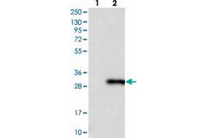 Western blot analysis of Lane 1: Negative control (vector only transfected HEK293T lysate), Lane 2: Over-expression Lysate (Co-expressed with a C-terminal myc-DDK tag (~3. (RAB14 antibody)