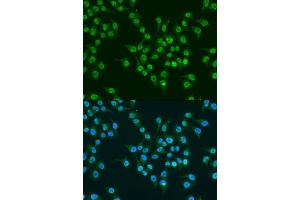 Immunofluorescence analysis of U2OS cells using KLF4 antibody. (KLF4 antibody  (AA 180-479))