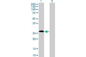 Western Blot analysis of IGSF6 expression in transfected 293T cell line by IGSF6 MaxPab polyclonal antibody.