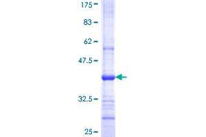 GDF3 Protein (AA 265-364) (GST tag)