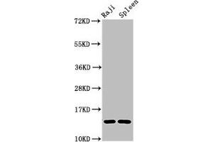 Western Blot Positive WB detected in: Raji whole cell lysate, Rat spleen tissue All lanes: GABARAPL2 antibody at 4 μg/mL Secondary Goat polyclonal to rabbit IgG at 1/50000 dilution Predicted band size: 14 kDa Observed band size: 14 kDa (GABARAPL2 antibody  (AA 1-117))