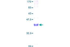 Neuregulin 4 Protein (NRG4) (AA 1-115) (GST tag)