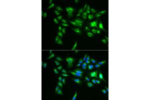 Immunofluorescence analysis of U2OS cell using POLG2 antibody. (POLG2 antibody)