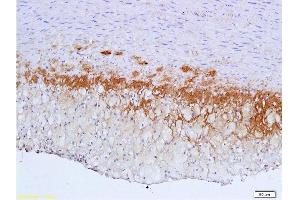 Formalin-fixed and paraffin embedded: rabbit carotid artery labeled with Anti-TGF-beta-R2/TGFBR2 Polyclonal Antibody , Unconjugated 1:600 followed by conjugation to the secondary antibody and DAB staining (TGFBR2 antibody  (AA 241-330))