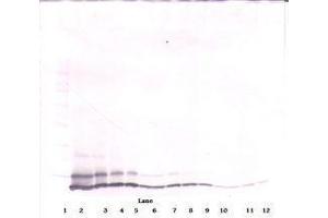 Image no. 3 for anti-Chemokine (C-X-C Motif) Ligand 1 (Melanoma Growth Stimulating Activity, Alpha) (CXCL1) antibody (ABIN465460) (CXCL1 antibody)