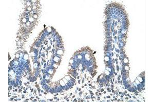 Image no. 1 for anti-Solute Carrier Family 22 (Organic Cation Transporter), Member 1 (SLC22A1) (C-Term) antibody (ABIN203397) (SLC22A1 antibody  (C-Term))