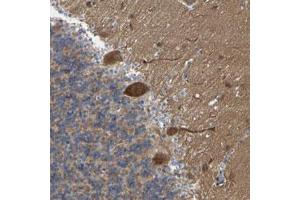 Immunohistochemical staining (Formalin-fixed paraffin-embedded sections) of human cerebellum with CIT polyclonal antibody  shows strong cytoplasmic positivity in Purkinje cells. (CIT antibody)