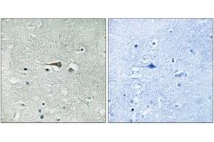 Immunohistochemistry analysis of paraffin-embedded human brain tissue, using TTK (Ab-676) Antibody. (Mps1 antibody  (AA 642-691))