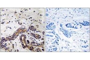 Immunohistochemistry analysis of paraffin-embedded human testis tissue, using CLASP1 Antibody. (CLASP1 antibody  (AA 1171-1220))