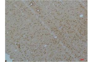 Immunohistochemistry (IHC) analysis of paraffin-embedded Rat Brain Tissue using Cav pan alpha1Rabbit Polyclonal Antibody diluted at 1:200. (Cav Pan Alpha1 (pan) antibody)