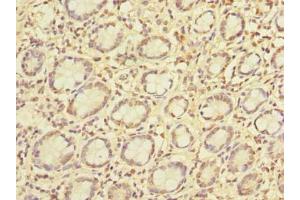 Immunohistochemistry of paraffin-embedded human small intestine tissue using ABIN7163413 at dilution of 1:100 (PCIF1 antibody  (AA 201-500))