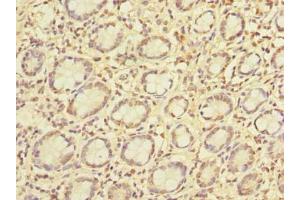 Immunohistochemistry of paraffin-embedded human small intestine tissue using ABIN7163413 at dilution of 1:100 (PCIF1 antibody  (AA 201-500))