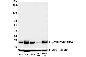 Western Blotting (WB) image for anti-Cyclin-Dependent Kinase Inhibitor 1A (p21, Cip1) (CDKN1A) (AA 100-150) antibody (ABIN7795765)