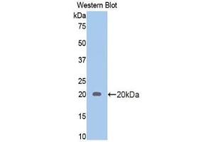 Western blot analysis of the recombinant protein. (Androgen Receptor antibody  (AA 765-902))