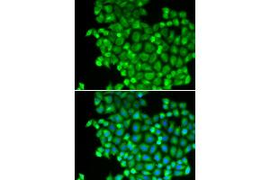 Immunofluorescence analysis of A549 cells using LDHA antibody (ABIN5970494). (Lactate Dehydrogenase A antibody)