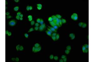 Immunofluorescence staining of PC-3 cells with ABIN7161661 at 1:200, counter-stained with DAPI. (NMRAL1 antibody  (AA 1-299))