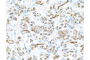 Immunohistochemistry (IHC) image for anti-CD34 (CD34) (AA 33-290) antibody (ABIN7453960) (Recombinant CD34 antibody  (AA 33-290))
