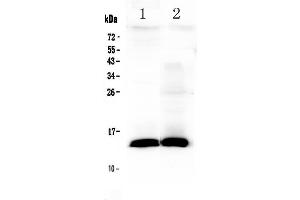Western blot analysis of TFF2 using anti-TFF2 antibody .