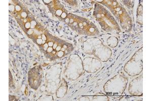 Immunoperoxidase of monoclonal antibody to CDC42BPB on formalin-fixed paraffin-embedded human small Intestine. (CDC42BPB antibody  (AA 1580-1679))