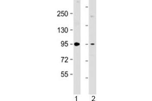 Western blot testing of 1) human brain lysate and 2) mouse NIH3T3 cell lysate with PKD2 antibody at 1:2000. (PKD2 antibody  (AA 556-590))