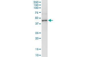 Immunoprecipitation of ADH4 transfected lysate using anti-ADH4 MaxPab rabbit polyclonal antibody and Protein A Magnetic Bead , and immunoblotted with ADH4 purified MaxPab mouse polyclonal antibody (B01P) . (ADH4 antibody  (AA 1-380))