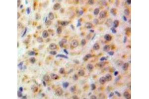 IHC-P analysis of Ovary tissue, with DAB staining. (NUP50 antibody  (AA 134-393))