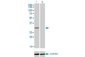 Western blot analysis of COASY over-expressed 293 cell line, cotransfected with COASY Validated Chimera RNAi (Lane 2) or non-transfected control (Lane 1). (COASY antibody  (AA 1-225))