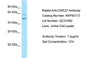 Western Blotting (WB) image for anti-CWC27 Spliceosome-Associated Protein Homolog (Cwc27) (C-Term) antibody (ABIN2788570) (Cwc27 antibody  (C-Term))