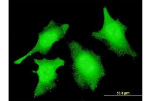 Immunofluorescence of monoclonal antibody to CASP2 on HeLa cell.