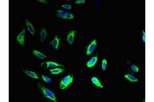 Immunofluorescence staining of Hela cells with ABIN7145178 at 1:400, counter-stained with DAPI. (BCAP31 antibody  (AA 2-243))