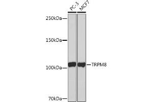 Western blot analysis of extracts of various cell lines, using TRPM8 Rabbit mAb (ABIN1678662, ABIN3018757, ABIN3018758 and ABIN7101657) at 1:1000 dilution. (TRPM8 antibody)