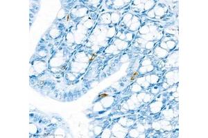 Immunohistochemistry of paraffin embedded mouse colon using IL34 (ABIN7074359) at dilution of 1:900 (400x lens) (IL-34 antibody)
