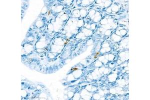 Immunohistochemistry of paraffin embedded mouse colon using IL34 (ABIN7074359) at dilution of 1:900 (400x lens) (IL-34 antibody)