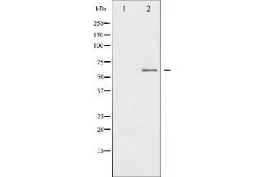 Western blot analysis of IL-10R alpha phosphorylation expression in HuvEc whole cell lysates,The lane on the left is treated with the antigen-specific peptide.