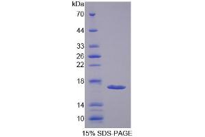 SDS-PAGE analysis of Rat HEXb Protein. (HEXB Protein)