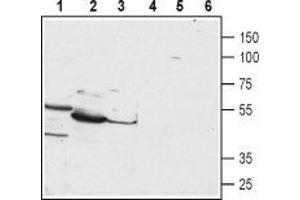 Western blot analysis of HepG2 (lanes 1 and 4), mouse liver (lanes 2 and 5) and rat liver (lanes 3 and 6) lysates: - 1-3.