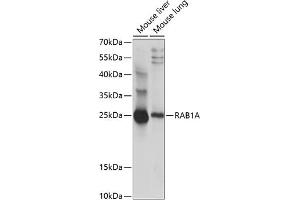 Western blot analysis of extracts of various cell lines, using RA antibody (ABIN7269797) at 1:1000 dilution. (RAB1A antibody  (AA 1-100))