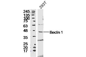 293T lyates probed with Rabbit Anti-Beclin 1 Polyclonal Antibody, Unconjugated  at 1:300 in 4˚C overnight. (Beclin 1 antibody  (AA 201-330))